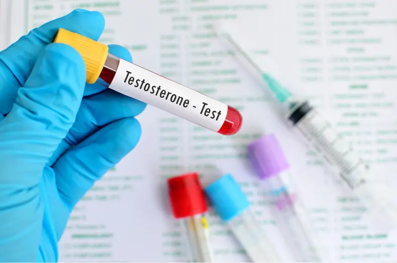 Testosterona em mulheres_ quando dosar e por que nem sempre repor é indicado - Dra ana barbara trizzotti endocrinologista botucatu lencois paulista
